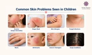 Common Skin Problems Seen in Children