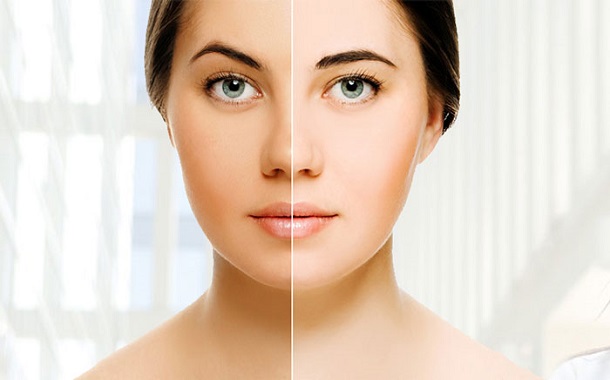 Skin Whitening Treatment: Attain a Flawless Complexion without Any Surgery  - Dr Rinky Kapoor