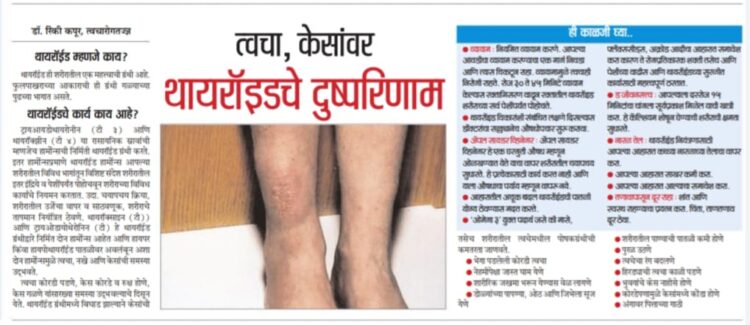 Thyroid Effects on Skin