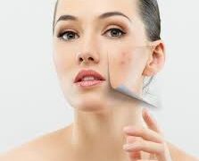 5 Tips for Choosing the Right Dermatologist