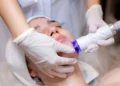 Sudden Craze for Laser Treatment for Skin Whitening: What’s Driving the Trend?