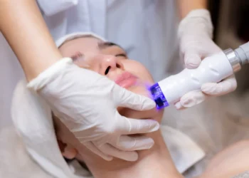 Sudden Craze for Laser Treatment for Skin Whitening: What’s Driving the Trend?