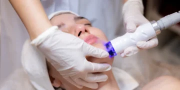Sudden Craze for Laser Treatment for Skin Whitening: What’s Driving the Trend?
