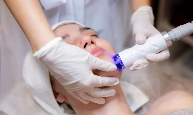 Sudden Craze for Laser Treatment for Skin Whitening: What’s Driving the Trend?