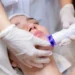 Sudden Craze for Laser Treatment for Skin Whitening: What’s Driving the Trend?