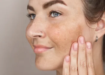Remove Dark Spots on Face