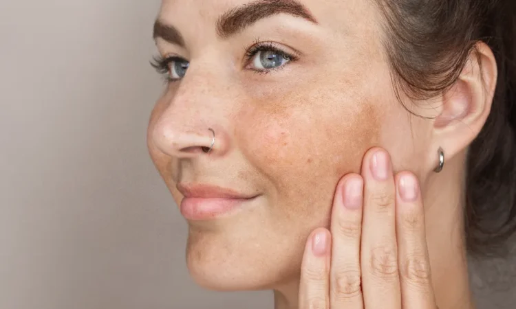 Remove Dark Spots on Face