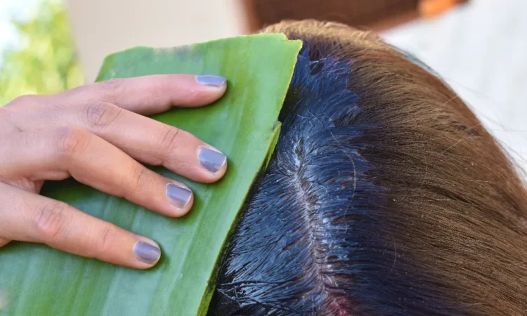 Aloe Vera for Dandruff
