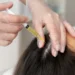 GFC Hair Treatment