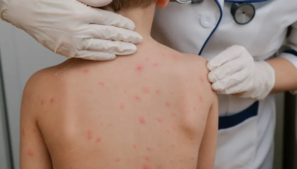 pediatric dermatologist