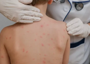 pediatric dermatologist