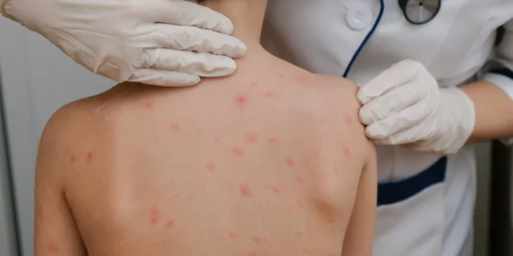pediatric dermatologist