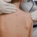 pediatric dermatologist