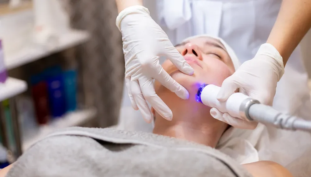 CO2 Laser Treatment