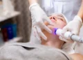 CO2 Laser Treatment