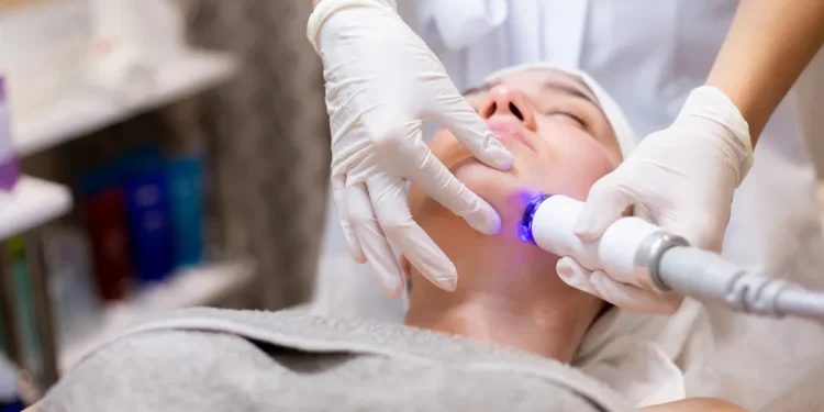 CO2 Laser Treatment
