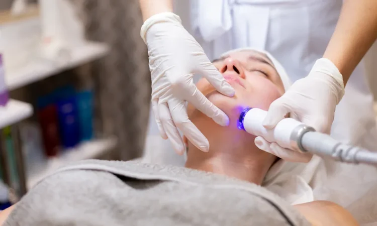 CO2 Laser Treatment