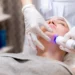 CO2 Laser Treatment