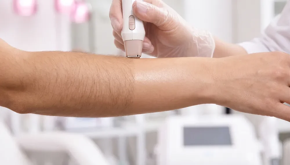 Permanent Laser Hair Removal