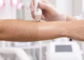 Permanent Laser Hair Removal