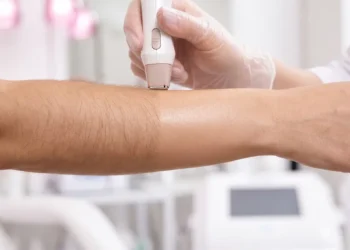 Permanent Laser Hair Removal