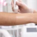Permanent Laser Hair Removal