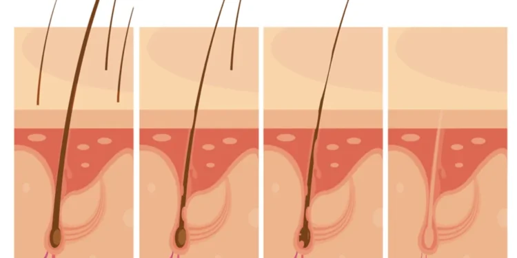 ingrown hair treatment at home