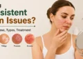 Facing persistent skin issues