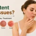 Facing persistent skin issues