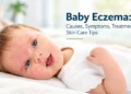 Baby Eczema Care Guide