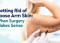 arm skin removal surgery