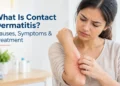 Understanding Contact Dermatitis